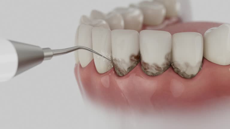 Reliable Dental contractor in Union City, IN by Dentist Open Now